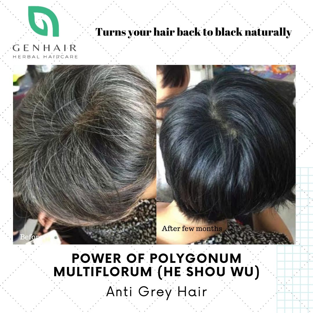 Reverse Gray White Hair And Hair Growth With Polygonum Multiflorum